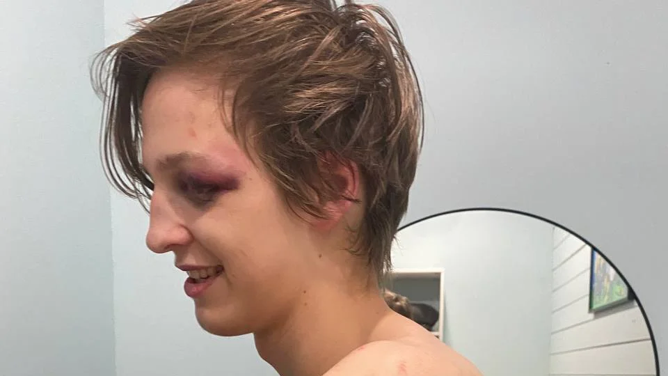 Активист из Калужской области рассказал, что во время обысков сотрудники ФСБ избили его и угрожали изнасиловать гантелей