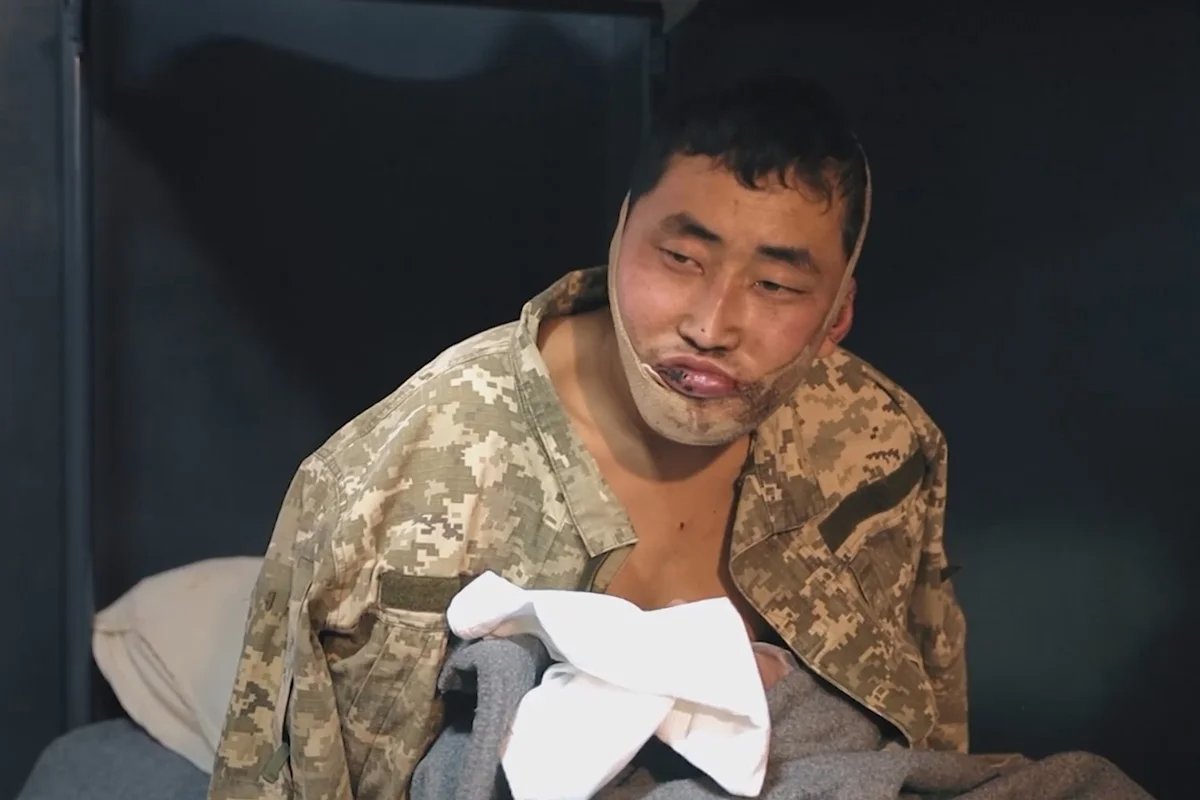 One of the two North Korean soldiers captured by the Ukrainian military. Photo: Zelensky / Telegram