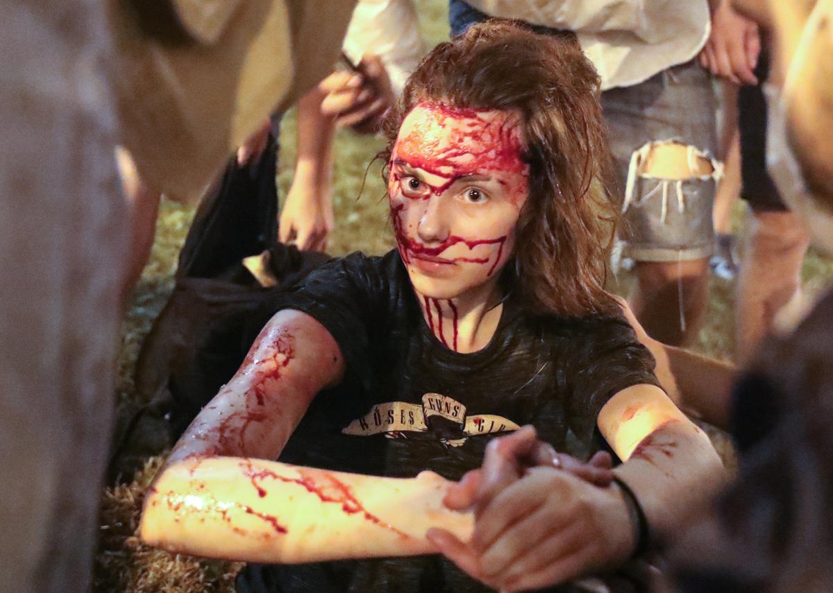 A protester injured during demonstrations against the stolen presidential elections, in Minsk, Belarus, 9 August 2020. Photo: EPA-EFE