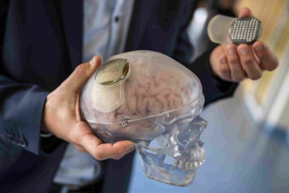 Нейробиологи из Швейцарского федерального технологического института Лозанны демонстрируют мозг с вживленными имплантами. Фото: EPA-EFE / JEAN-CHRISTOPHE BOTT