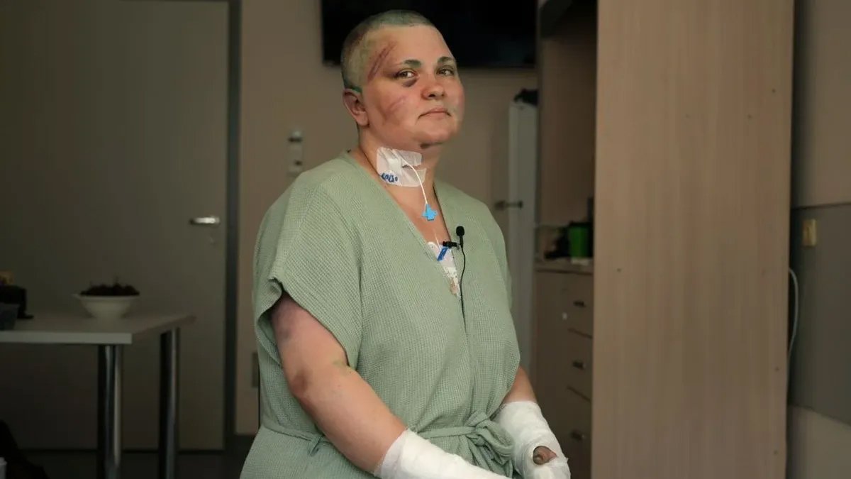 Фото: Елена Милашина в больнице после избиения