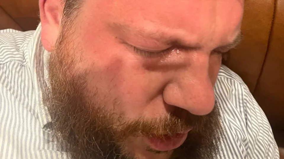 В Польше задержали заказчика и исполнителей атаки на соратника Навального Леонида Волкова