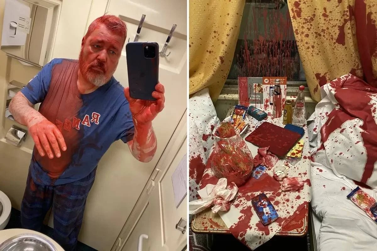 Novaya Gazeta editor-in-chief and Nobel Peace Prize laureate Dmitry Muratov right after the attack when an unknown man threw red paint on him. Photo: Dmitry Muratov / Novaya Gazeta