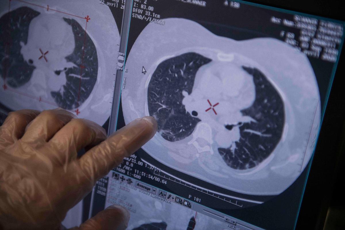 Радиолог смотрит на снимок пациента с подозрением на коронавирус. Фото: EPA-EFE / Julien de Rosa