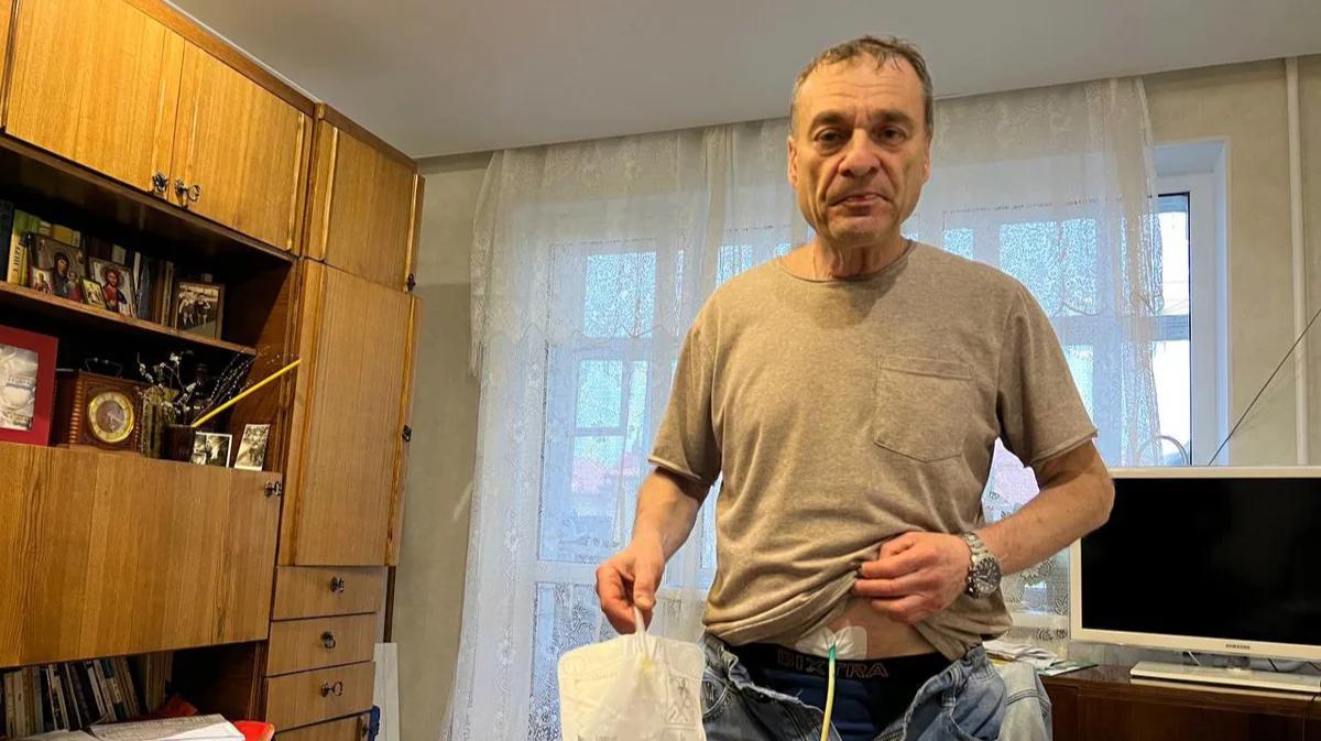 Игорь Барышников с установленной в животе специальной трубкой с мочеприёмником. Фото:&nbsp;<a target="_blank" data-stringify-link="https://t.me/sotaproject/71125" data-sk="tooltip_parent" href="https://t.me/sotaproject/71125" rel="noopener noreferrer">SOTA</a>